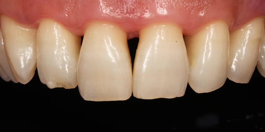 B36ed41f251d8b12f15303a6c3b44858