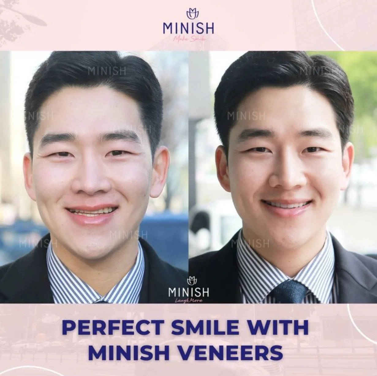 D2f434a476f1a3ccb72b74a46025e007