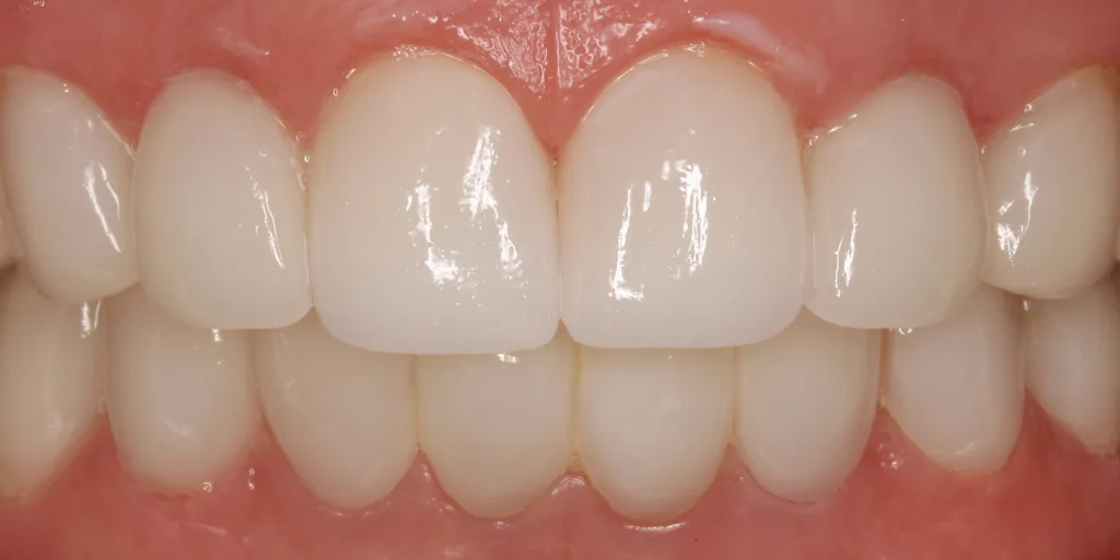 13a32e13c6fc166fee03051e6262b64b