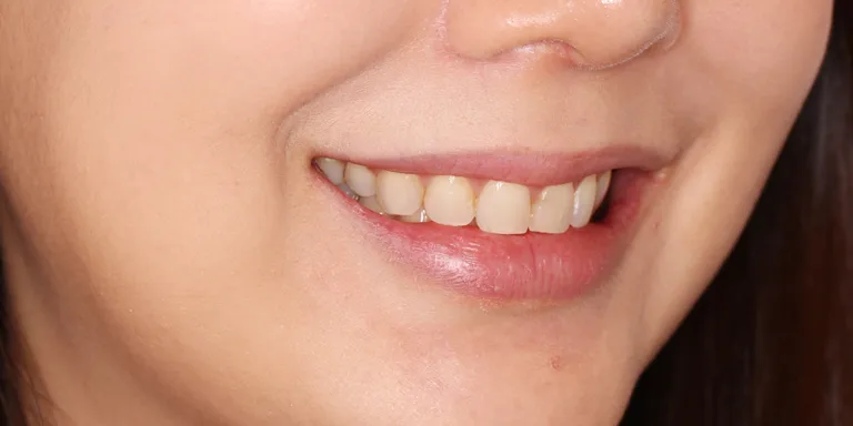 868caedc5de9d613fc1328023ce2f740
