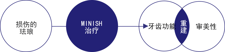 MINISH牙科|MINISH种植牙|MINISH种植牙价格|MINISH全瓷牙修复|MINISH牙科医院|MINISH牙齿贴面|韩国牙科医院|韩国牙齿整形医院|韩国牙齿美容医院|韩国牙科整形价格 재건 치료 다이어그램