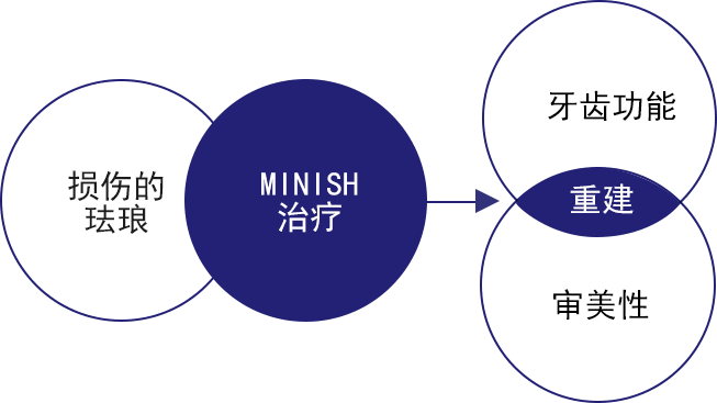 MINISH牙科|MINISH种植牙|MINISH种植牙价格|MINISH全瓷牙修复|MINISH牙科医院|MINISH牙齿贴面|韩国牙科医院|韩国牙齿整形医院|韩国牙齿美容医院|韩国牙科整形价格 재건 치료 다이어그램