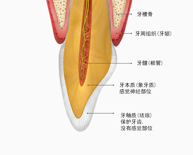 치아단면도