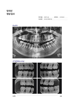 앞니 건강 검진 결과지