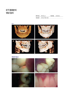 앞니 건강 검진 결과지