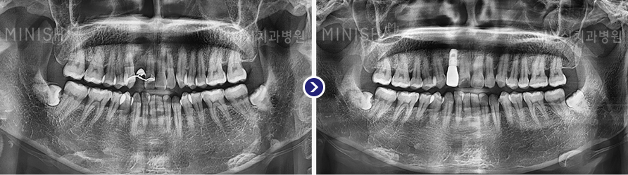 파노라마 3